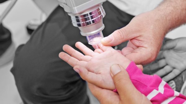 Dermatologe behandelt den Finger eines kleinesn Mädchens mit Infrarotlicht